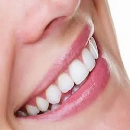 44% Teeth Whitening Gel - How Strong is Too Strong 