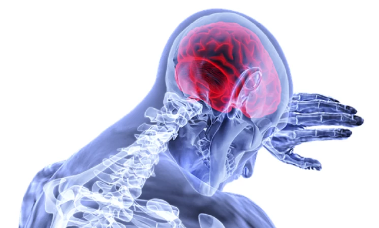 Getting The Right Compensation For Brain Injuries After A Car Accident