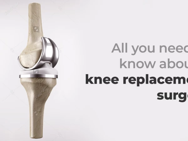 All you need to know about a knee replacement surgery
